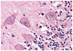 COMT Rabbit anti-Human, Polyclonal Antibody, Abnova 50&mu;g; Unlabeled:Antibodies,