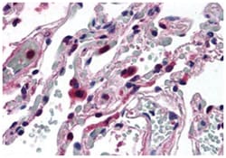 ELOVL5 Rabbit anti-Human, Polyclonal Antibody, Abnova 50 &mu;g | Buy Online | Abnova Corporation | Fisher Scientific