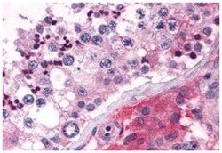ELOVL5 Rabbit anti-Human, Polyclonal Antibody, Abnova 50 &mu;g | Buy Online | Abnova Corporation | Fisher Scientific
