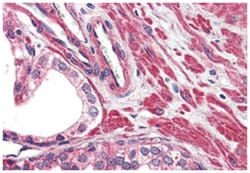 TRPV2 Rabbit anti-Human, Polyclonal Antibody, Abnova 50 &mu;g | Buy Online | Abnova Corporation | Fisher Scientific