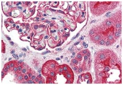 TRPM4 Rabbit anti-Human, Polyclonal Antibody, Abnova 50 &mu;g | Buy Online | Abnova Corporation | Fisher Scientific
