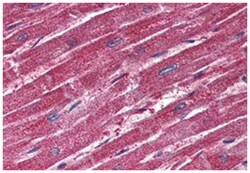 TRPM4 Rabbit anti-Human, Polyclonal Antibody, Abnova 50 &mu;g | Buy Online | Abnova Corporation | Fisher Scientific