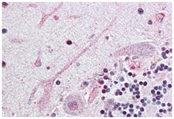 SCN3A Rabbit anti-Human, Polyclonal Antibody, Abnova 50 &mu;g | Buy Online | Abnova Corporation | Fisher Scientific