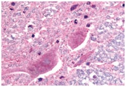 SCN3A Rabbit anti-Human, Polyclonal Antibody, Abnova 50 &mu;g | Buy Online | Abnova Corporation | Fisher Scientific