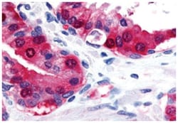 TRPM8 Rabbit anti-Chicken, Dog, Guinea pig, Hamster, Horse, Human, Mouse, Rabbit, Rat, Polyclonal Antibody, Abnova 50 &mu;g | Buy Online | Abnova Corporation | Fisher Scientific