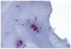 ACAN Rabbit anti-Human, Mouse, Rat, Polyclonal Antibody, Abnova 50&mu;g;