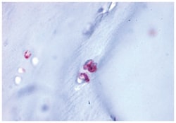 ACAN Rabbit anti-Hamster, Human, Monkey, Rat, Polyclonal Antibody, Abnova