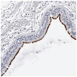 C1orf173, Rabbit, Polyclonal Antibody, Abnova 100 &mu;L | Buy Online | Abnova Corporation | Fisher Scientific