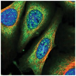 ARHGAP18 Rabbit anti-Human, Polyclonal Antibody, Abnova 100&mu;L; Unlabeled:Antibodies,