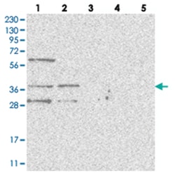 WDR92 Rabbit anti-Human, Polyclonal Antibody, Abnova 100 &mu;L | Buy Online | Abnova Corporation | Fisher Scientific