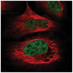 WDR92 Rabbit anti-Human, Polyclonal Antibody, Abnova 100 &mu;L | Buy Online | Abnova Corporation | Fisher Scientific