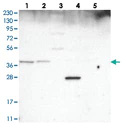 WDR92 Rabbit anti-Human, Polyclonal Antibody, Abnova 100 &mu;L | Buy Online | Abnova Corporation | Fisher Scientific