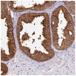 WDR92 Rabbit anti-Human, Polyclonal Antibody, Abnova 100 &mu;L | Buy Online | Abnova Corporation | Fisher Scientific