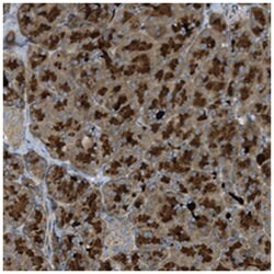STARD13 Rabbit anti-Human, Polyclonal Antibody, Abnova 100 &mu;L | Buy Online | Abnova Corporation | Fisher Scientific