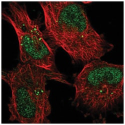 KDELC2 Rabbit anti-Human, Polyclonal Antibody, Abnova 100 &mu;L | Buy Online | Abnova Corporation | Fisher Scientific