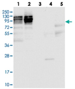 NOP2 Rabbit anti-Human, Polyclonal Antibody, Abnova 100&mu;L; Unlabeled:Antibodies,