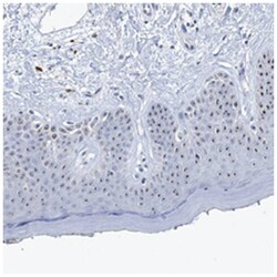 NOP2 Rabbit anti-Human, Polyclonal Antibody, Abnova 100&mu;L; Unlabeled:Antibodies,