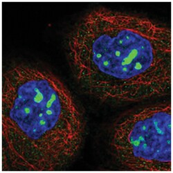 NOP2 Rabbit anti-Human, Polyclonal Antibody, Abnova 100&mu;L; Unlabeled:Antibodies,