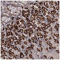SPATC1 Rabbit anti-Human, Polyclonal Antibody, Abnova 100 &mu;L | Buy Online | Abnova Corporation | Fisher Scientific