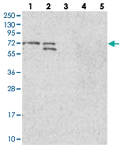 BRAP, Rabbit, Polyclonal Antibody, Abnova 100&mu;L; Unlabeled:Antibodies,