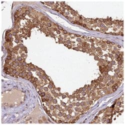 BRAP, Rabbit, Polyclonal Antibody, Abnova 100&mu;L; Unlabeled:Antibodies,