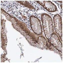 ZNF609 Rabbit anti-Human, Polyclonal Antibody, Abnova 100&mu;L; Unlabeled:Antibodies,
