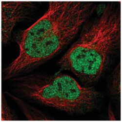 ZNF609 Rabbit anti-Human, Polyclonal Antibody, Abnova 100&mu;L; Unlabeled:Antibodies,