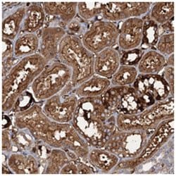 CCDC81 Rabbit anti-Human, Polyclonal Antibody, Abnova 100 &mu;L | Buy Online | Abnova Corporation | Fisher Scientific