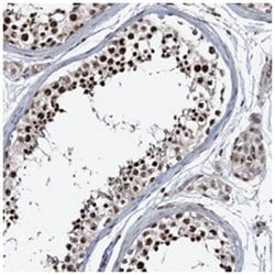 ZNF609 Rabbit anti-Human, Polyclonal Antibody, Abnova 100 &mu;L | Buy Online | Abnova Corporation | Fisher Scientific