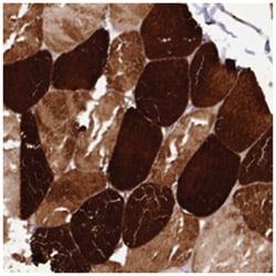 ANKRD2 Rabbit anti-Human, Polyclonal Antibody, Abnova 100 &mu;L | Buy Online | Abnova Corporation | Fisher Scientific