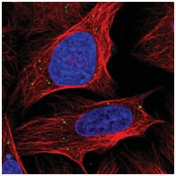 ANKRD2 Rabbit anti-Human, Polyclonal Antibody, Abnova 100 &mu;L | Buy Online | Abnova Corporation | Fisher Scientific