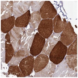 ANKRD2 Rabbit anti-Human, Polyclonal Antibody, Abnova 100 &mu;L | Buy Online | Abnova Corporation | Fisher Scientific