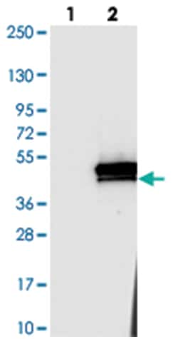 ANKRD2 Rabbit anti-Human, Polyclonal Antibody, Abnova 100 &mu;L | Buy Online | Abnova Corporation | Fisher Scientific