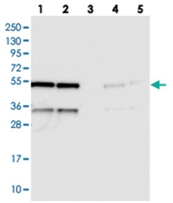 C20orf72, Rabbit, Polyclonal Antibody, Abnova 100 &mu;L | Buy Online | Abnova Corporation | Fisher Scientific