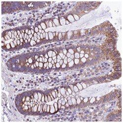 C20orf72, Rabbit, Polyclonal Antibody, Abnova 100 &mu;L | Buy Online | Abnova Corporation | Fisher Scientific