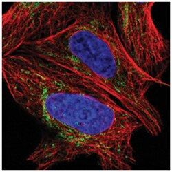 C20orf72, Rabbit, Polyclonal Antibody, Abnova 100 &mu;L | Buy Online | Abnova Corporation | Fisher Scientific