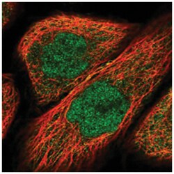 OSBPL1A Rabbit anti-Human, Polyclonal Antibody, Abnova 100&mu;L; Unlabeled:Antibodies,