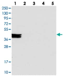 FAM217B, Rabbit, Polyclonal Antibody, Abnova 100 &mu;L | Buy Online | Abnova Corporation | Fisher Scientific