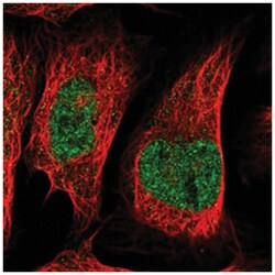 FAM217B, Rabbit, Polyclonal Antibody, Abnova 100 &mu;L | Buy Online | Abnova Corporation | Fisher Scientific
