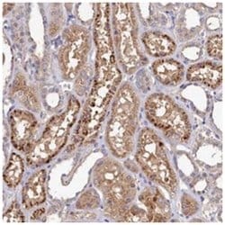 TK2 Rabbit anti-Human, Polyclonal Antibody, Abnova 100&mu;L; Unlabeled:Antibodies,