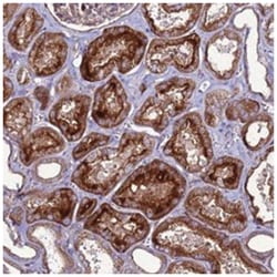 NRN1L, Rabbit, Polyclonal Antibody, Abnova 100 &mu;L | Buy Online | Abnova Corporation | Fisher Scientific