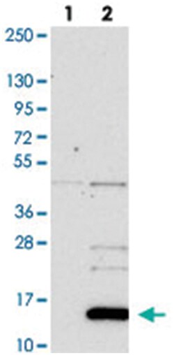NRN1L, Rabbit, Polyclonal Antibody, Abnova 100 &mu;L | Buy Online | Abnova Corporation | Fisher Scientific