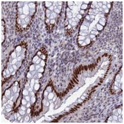 C20orf112 Rabbit anti-Human, Polyclonal Antibody, Abnova 100 &mu;L | Buy Online | Abnova Corporation | Fisher Scientific