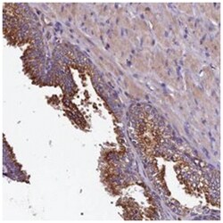 CLN5, Rabbit, Polyclonal Antibody, Abnova 100&mu;L; Unlabeled:Antibodies,