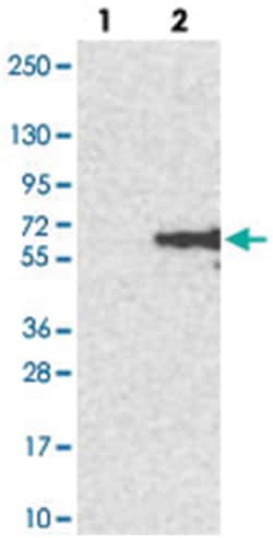 CLN5, Rabbit, Polyclonal Antibody, Abnova 100&mu;L; Unlabeled:Antibodies,