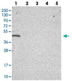 C19orf47 Rabbit anti-Human, Polyclonal Antibody, Abnova 100 &mu;L | Buy Online | Abnova Corporation | Fisher Scientific