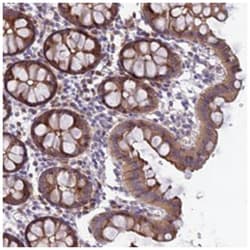 FAM125A Rabbit anti-Human, Polyclonal Antibody, Abnova 100 &mu;L | Buy Online | Abnova Corporation | Fisher Scientific