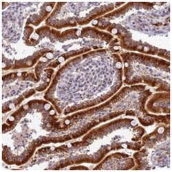 HEATR5B, Rabbit, Polyclonal Antibody, Abnova 100 &mu;L | Buy Online | Abnova Corporation | Fisher Scientific