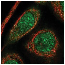 HEATR5B, Rabbit, Polyclonal Antibody, Abnova 100 &mu;L | Buy Online | Abnova Corporation | Fisher Scientific