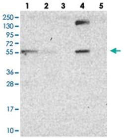 DUS2L Rabbit anti-Human, Polyclonal Antibody, Abnova 100 &mu;L | Buy Online | Abnova Corporation | Fisher Scientific
